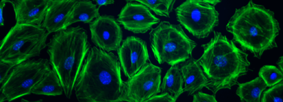 Coordination and administration of the Clinical Research Unit (KFO 329)