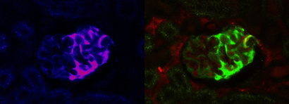 The dynamic interplay of Calcium signaling and actin remodeling in podocytes