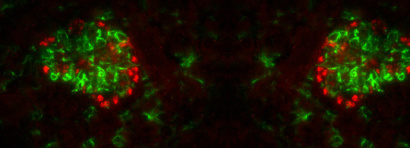 Gene-regulatory networks in podocytes in health and disease