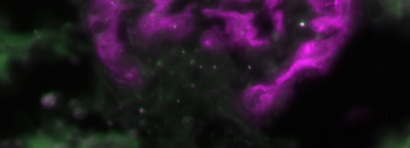 DNA damage response pathways in podocytes: novel targets to treat focal segmental glomerulosclerosis