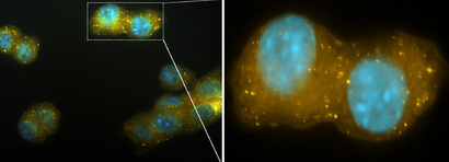 Podocyte lncRNAs: novel players in FSGS