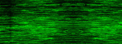 Sequencing-based innovative approaches to study FSGS